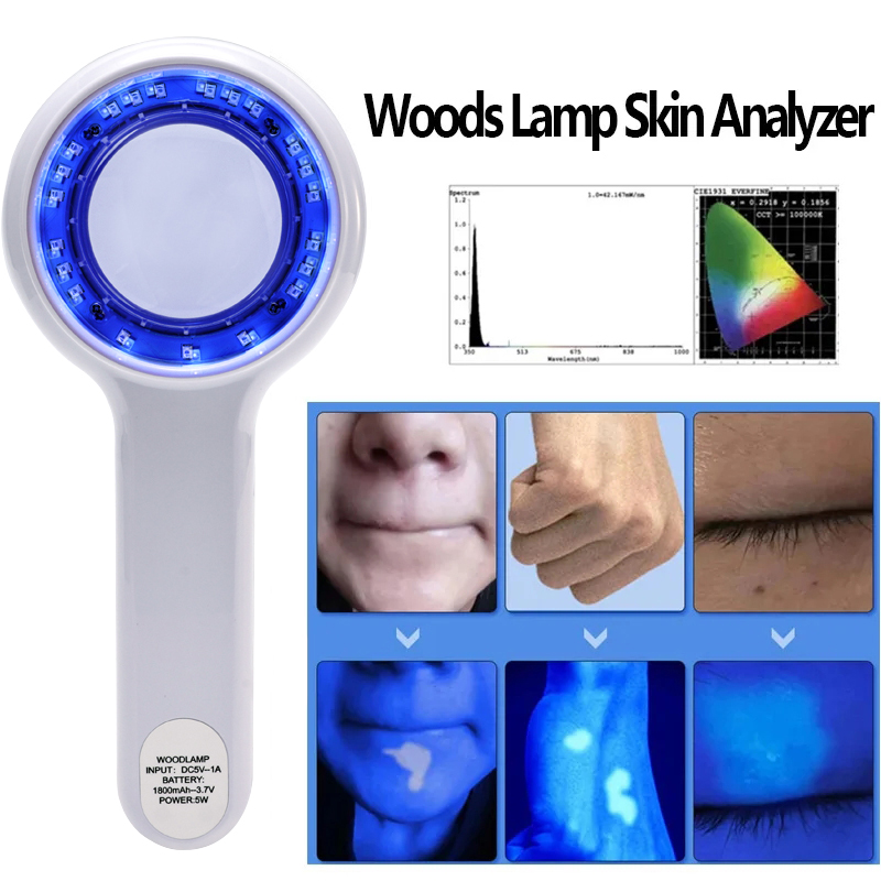 Hair Porosity Test - NEW Woods Lamp Skin Analyzer Portable