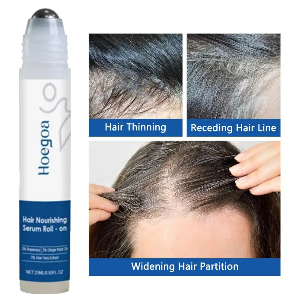 25ml 3% Rosemary Hair Growth S - Hair Care Essence Oil ulasan dan harga