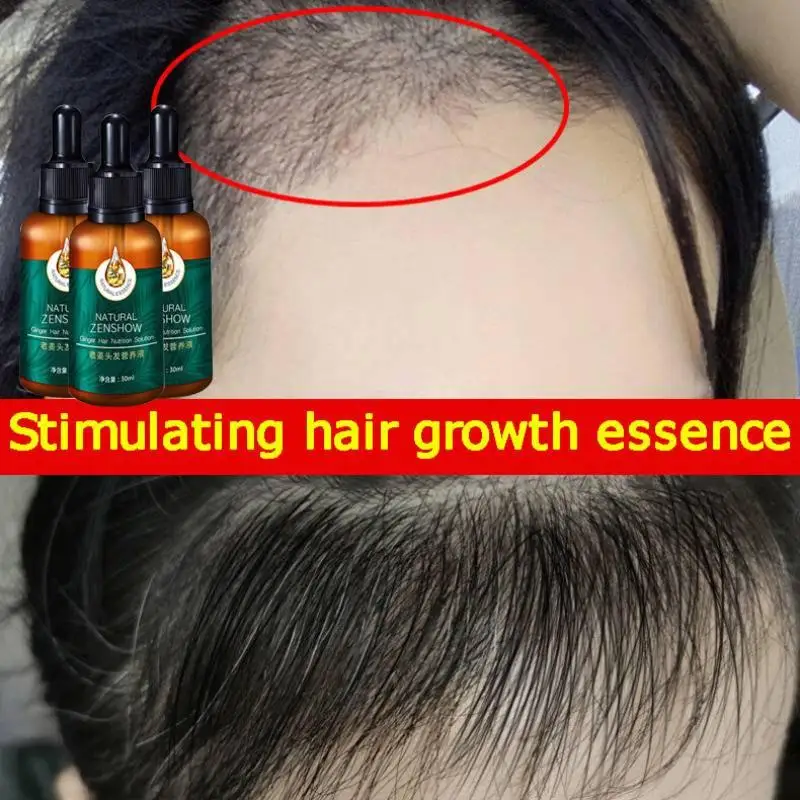 Ginger Hair Growth Essential O - Hair Care Herbal Products ulasan dan harga