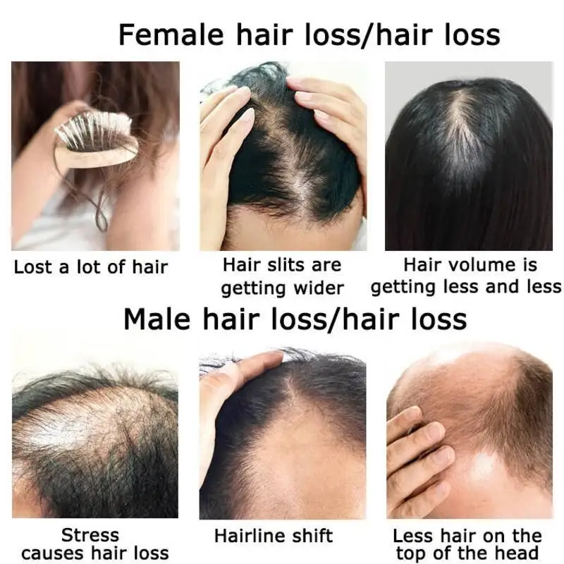 Ginger Hair Growth Essential O - Hair Care Herbal Products ulasan dan harga