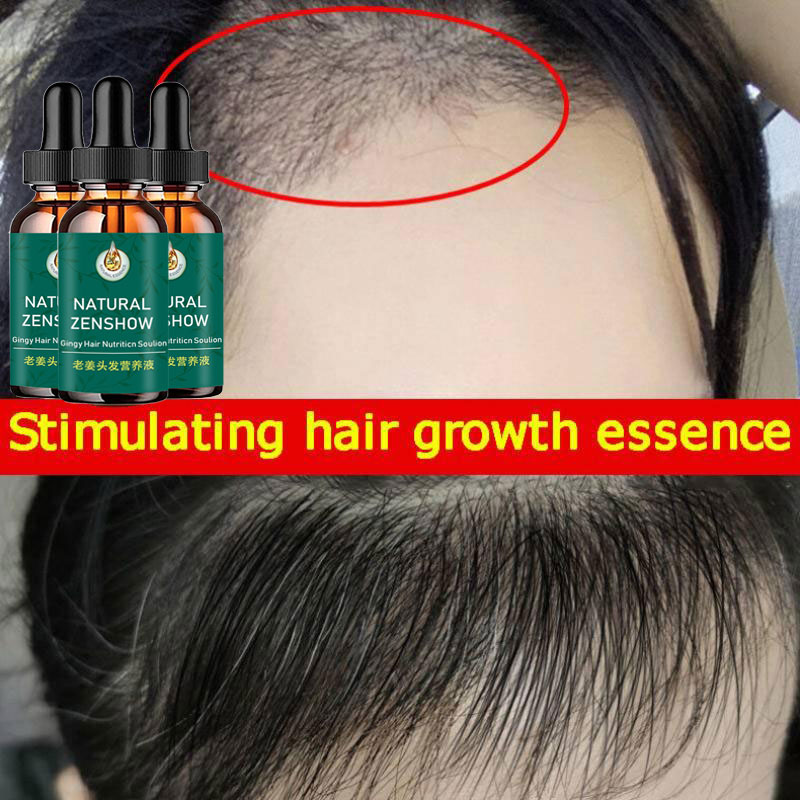 Ginger Hair Growth Essential O - Hair Care Herbal Products ulasan dan harga