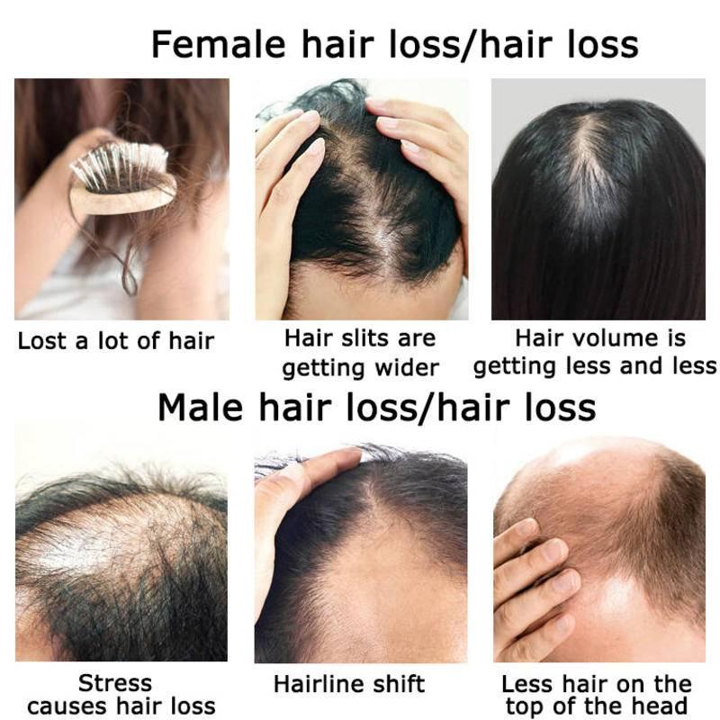 Ginger Hair Growth Essential O - Hair Care Herbal Products ulasan dan harga