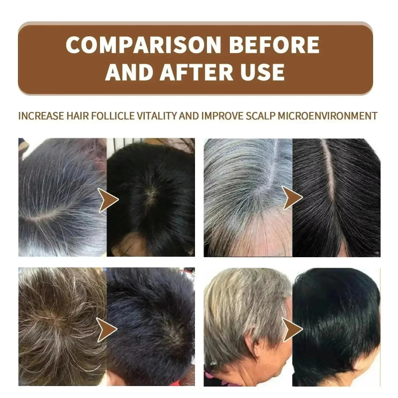 Herbal Anti-grey Treatment Hai - Hair Care Herbal Products ulasan dan harga