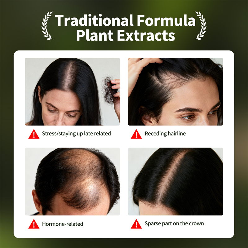 Natural Hair Growth Set Usman  - Hair Care Frizzy Hair ulasan dan harga