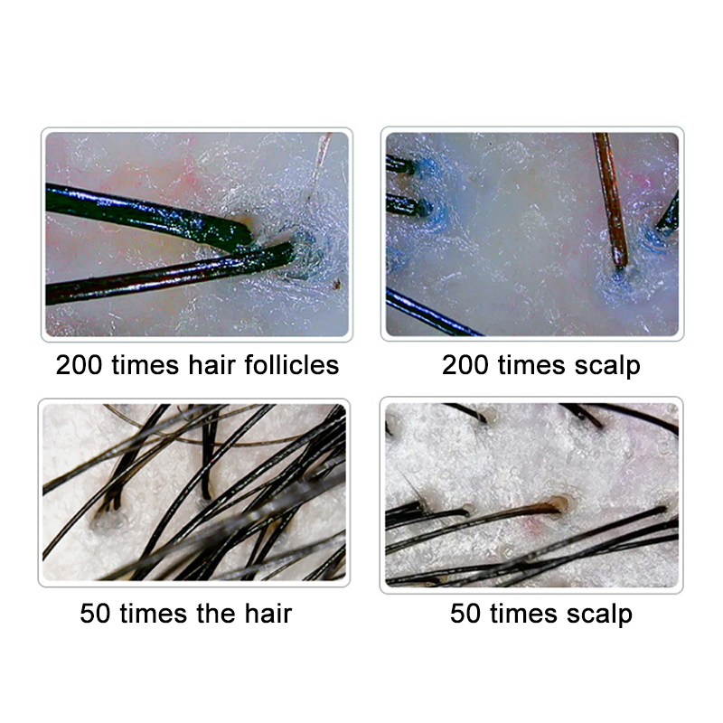200/50X Skin Hair Scalp Detect - Hair Porosity Test ulasan dan harga