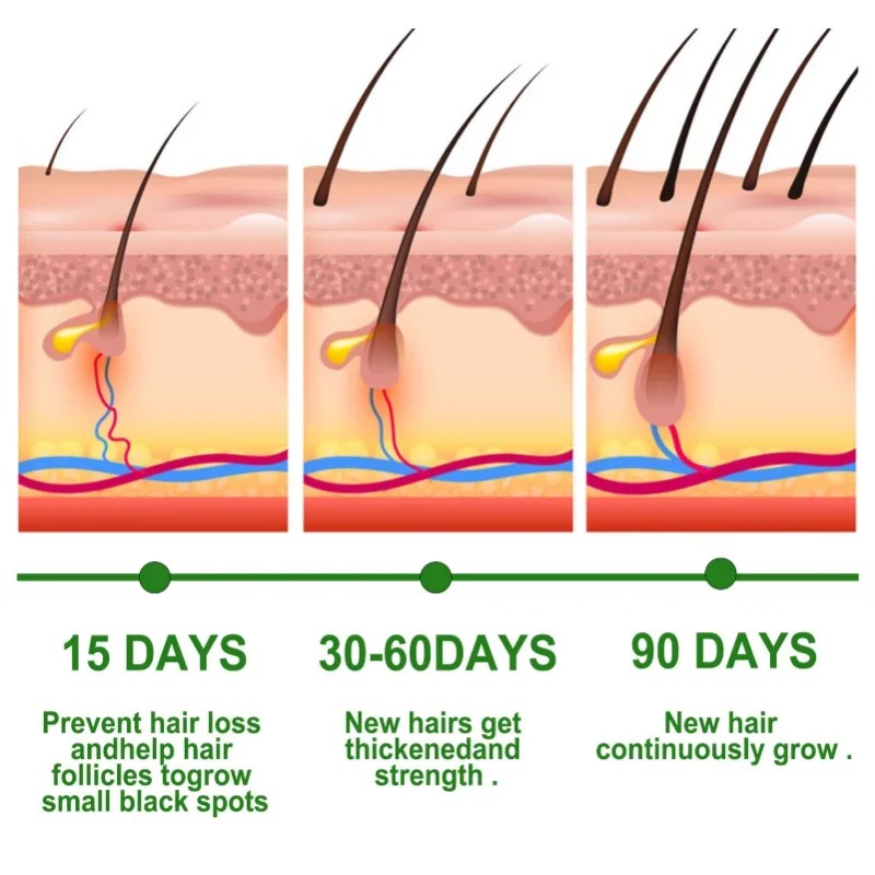 Hair Growth Serum Fast Growing - Hair Care Fragrance Essential Oil ulasan dan harga