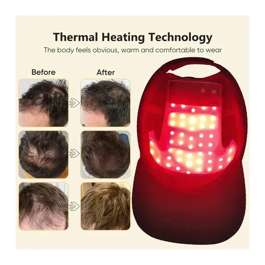 NEW LED Red Blue Light Therapy - Hair Care Vegan ulasan dan harga