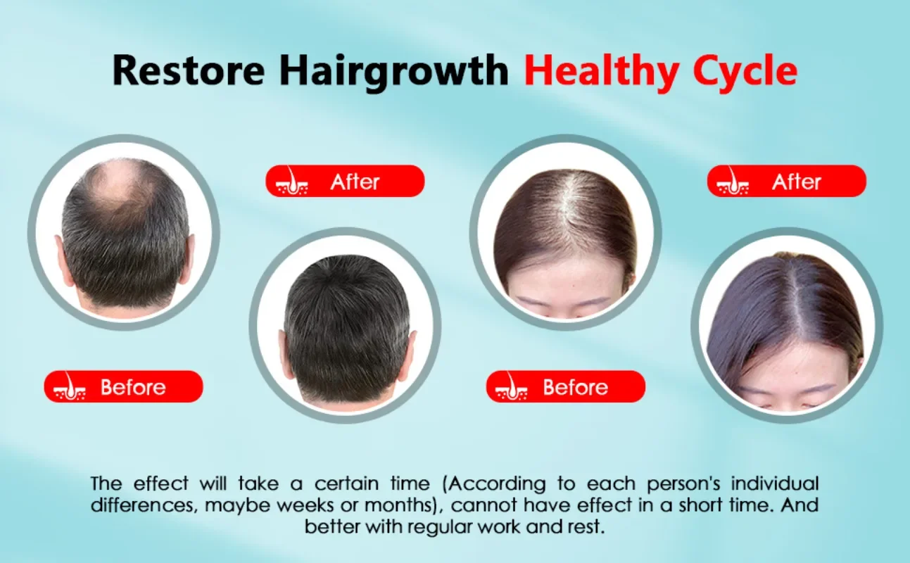 Hair Growth Cap Rechargeable 2 - Hair Care Vegan ulasan dan harga