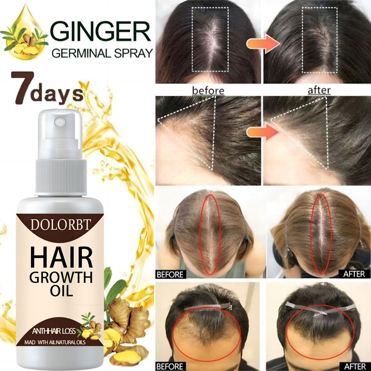 Hair Growth Essence Oil Spray  - Hair Care Herbal Products ulasan dan harga