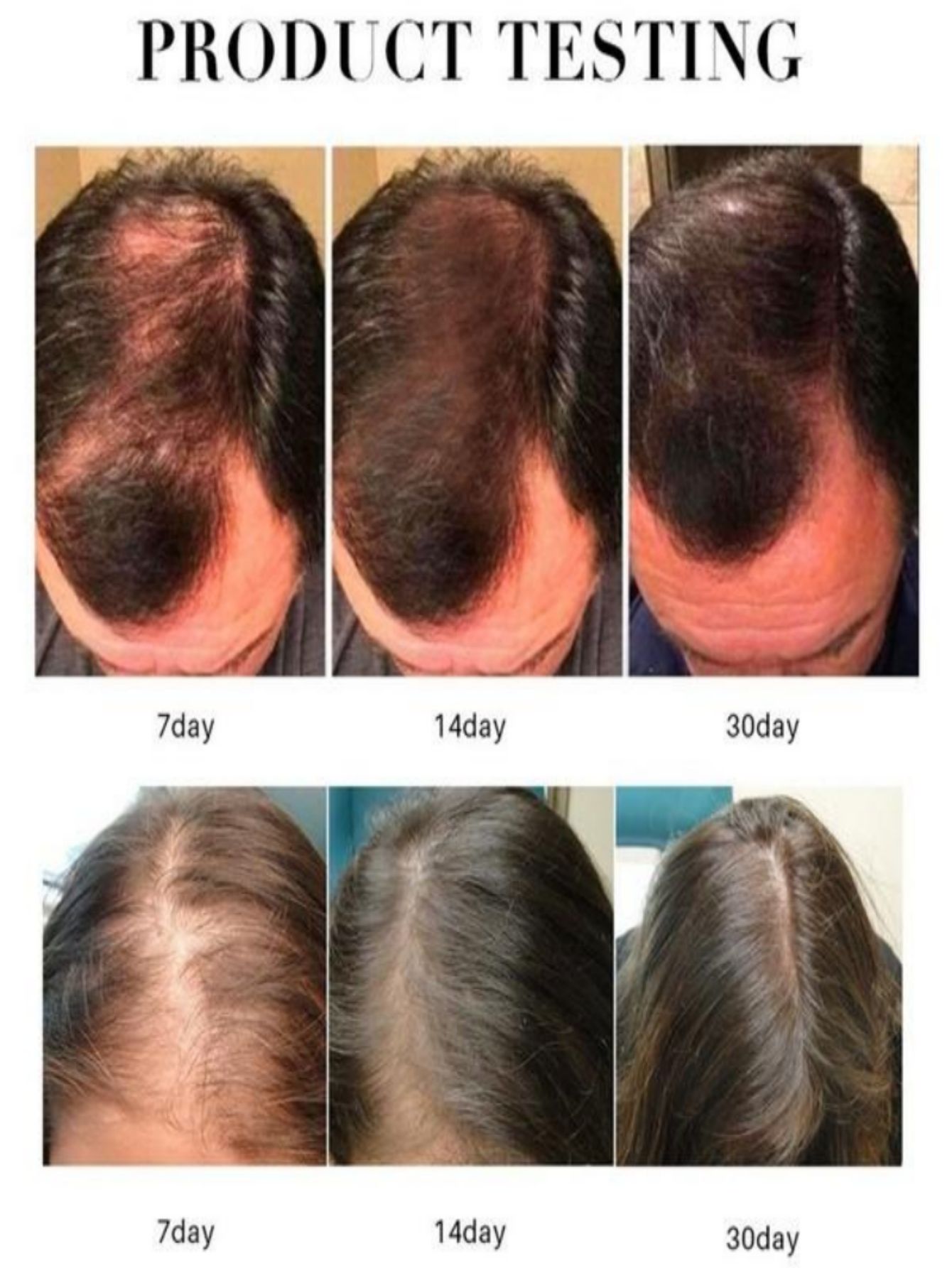 Hair Growth Essence Oil Spray  - Hair Care Herbal Products ulasan dan harga