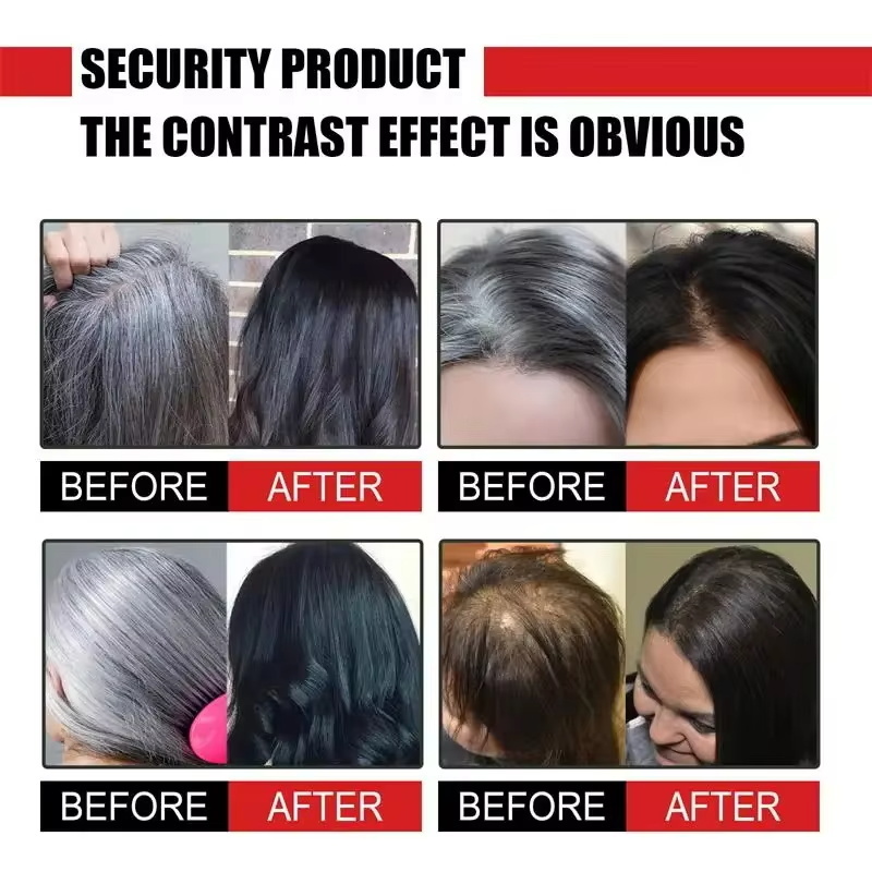 Herbal Anti-grey Hair Treatmen - Hair Care Herbal Products ulasan dan harga
