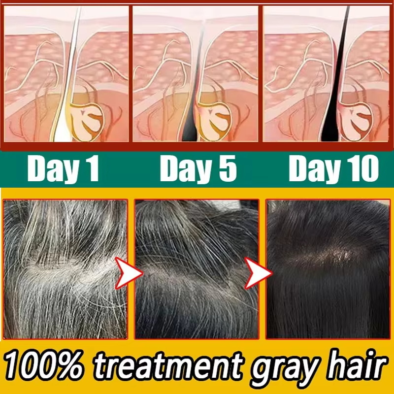 Herbal Anti-grey Hair Treatmen - Hair Care Herbal Products ulasan dan harga