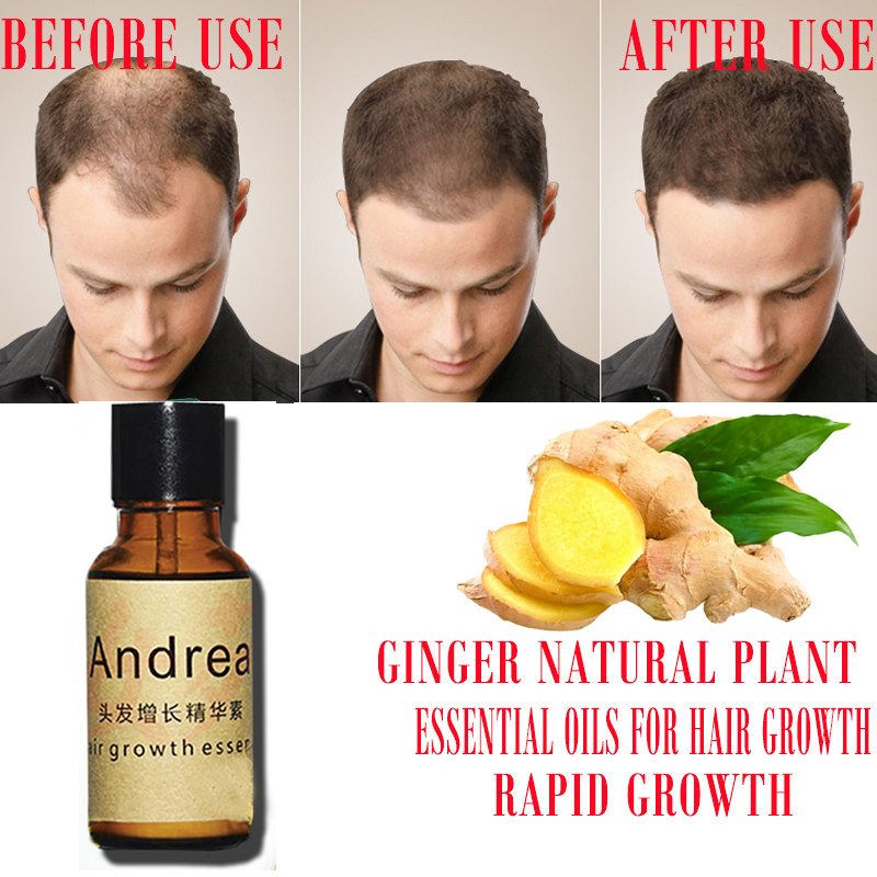 2/5/10Pcs Andrea Hair Growth S - Hair Care Herbal Products ulasan dan harga