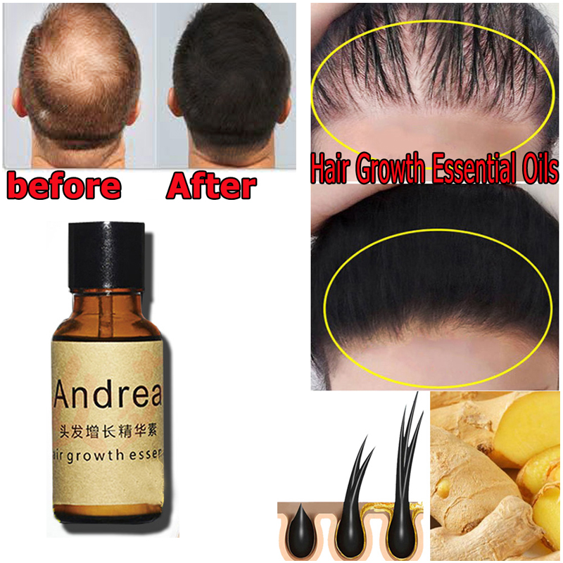 2/5/10Pcs Andrea Hair Growth S - Hair Care Herbal Products ulasan dan harga