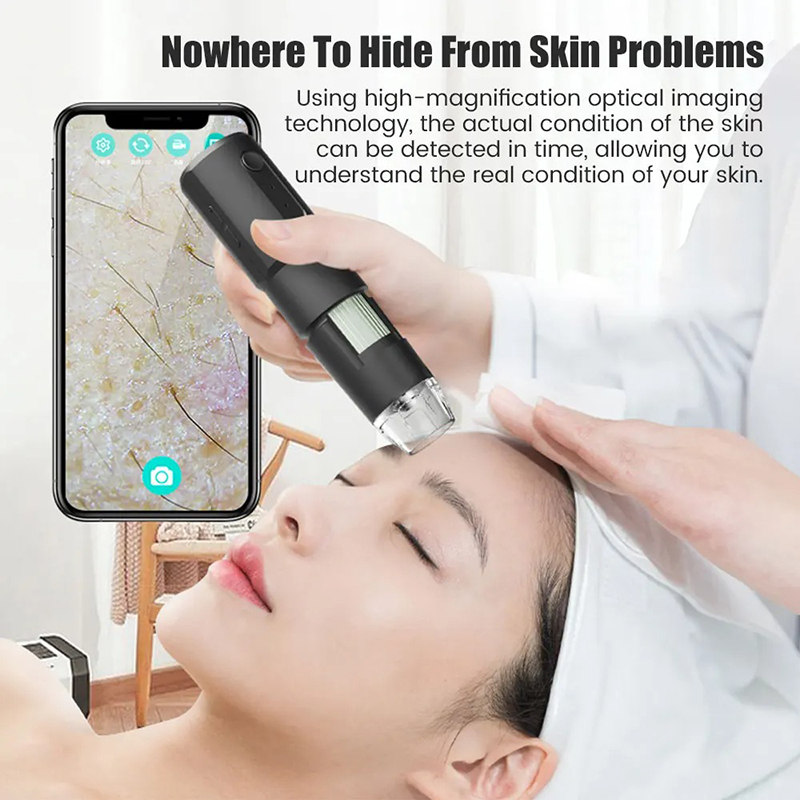 Wireless Dermatoscope Scalp Sk - Hair Porosity Test ulasan dan harga